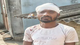 चोरों के हमले से घायल कमल कुमार साव।