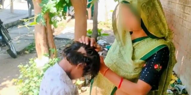 स्कूल में तालिबानी सजा, लंच ब्रेक में घर जाने पर नाराज शिक्षक ने छात्रा को डंडे से पीटा; बाल नोंच डाले