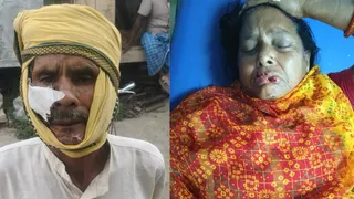 सरैया में कुत्ते के हमले में जख्मी ग्रामीण। फोटो: जागरण