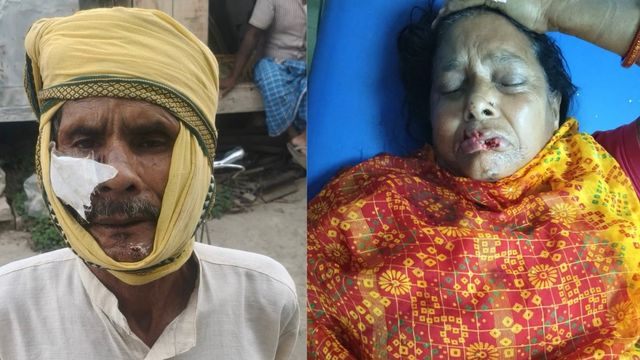 मुजफ्फरपुर के सरैया में आवारा कुत्ते का आतंक, 50 लोगों को दौड़ा-दौड़ाकर काटा, आधा दर्जन गंभीर