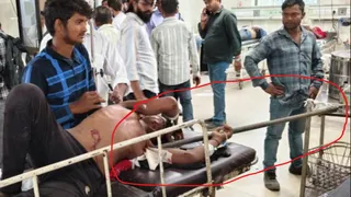 अलीगढ़ के अस्पताल में शरीर में धंसी लेकर पहुंचा युवक।