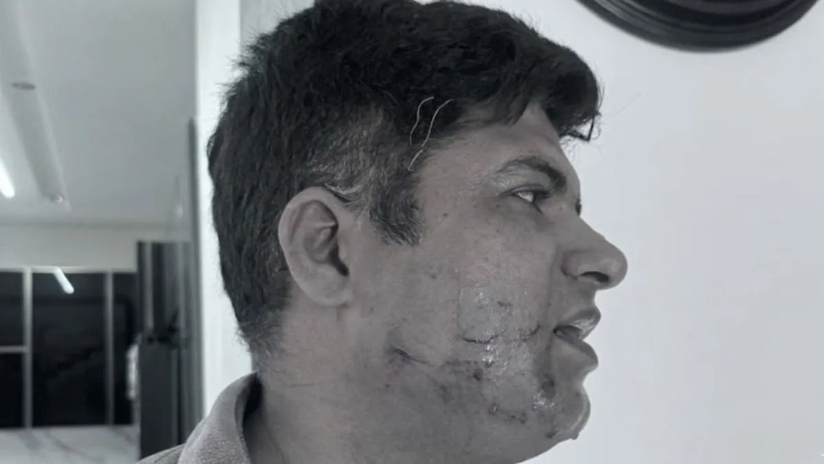 देहरादून: MDDA की जमीन पर अवैध निर्माण के विरोध पर बिल्डर ने DRDO के साइंटिस्ट को पीटा, FIR दर्ज