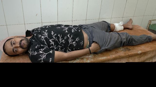 गाजीपुर में ईंट भट्ठा मालिक पर फायरिंग का आरोपी मुठभेड़ में गिरफ्तार, पैर में लगी गोली
