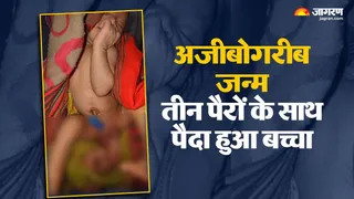 दुर्लभ मेडिकल केस: तीन पैरों वाले नवजात को देख डॉक्टर भी चकित
