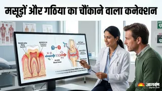मसूड़ों की बीमारी और गठिया का गहरा संबंध (Picture Credit- AI Generated)