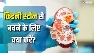 किडनी स्टोन से बचने के लिए पर्याप्त पानी पीना जरूरी। सांकेतिक तस्वीर