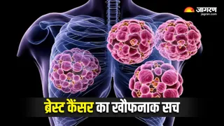 भारत में ब्रेस्ट कैंसर का बढ़ता खतरा: 13% मरीजों के अन्य अंगों तक फैली बीमारी (Image Source: Freepik)