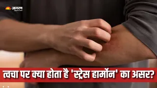 ज्यादा स्ट्रेस के कारण बढ़ सकती हैं त्वचा से जुड़ी समस्याएं (Picture Courtesy: Freepik)