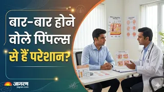 चेहरे के एक ही हिस्से में बार-बार पिंपल क्यों? (Image Source: AI-Generated)
