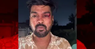 घायल दुकानदार।