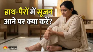 क्या आपको भी है गर्मी में हाथ-पैर सूजने की शिकायत? (Image Source: AI-Generated)