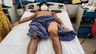 कूल्हा प्रत्यारोपण के बाद प्रयागराज के MLN मेडिकल कॉलेज में भर्ती युवक। जागरण