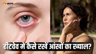हीटवेव से आंखों में जलन और सनबर्न का खतरा (Picture Courtesy: Freepik)