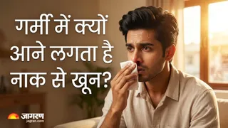 गर्मियों में नाक से खून आने के कारण, बचाव और डॉक्टर की सलाह (Image Source: AI-Generated)