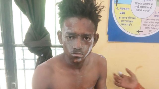 बाराबंकी में मेंथा पेराई के दौरान टंकी फटी, मां-बेटे समेत तीन झुलसे; गंभीर हालत में रेफर
