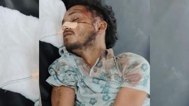 मौत को दी मात, पर याददाश्त खो बैठा हमले का शिकार दीपांशु; हापुड़ पुलिस की कार्रवाई पर उठे सवाल
