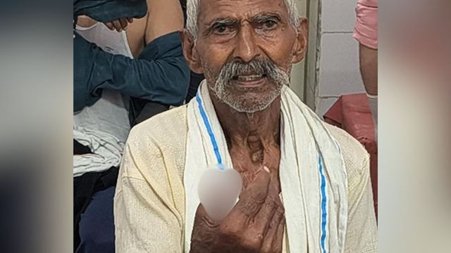 एटा में बुजुर्ग पर आवारा कुत्ते ने किया हमला, हाथ का अंगूठा काटकर ले भागा
