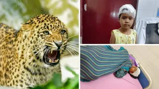 गुलदार के हमले में घायल सात वर्षीय बच्ची और महिला।