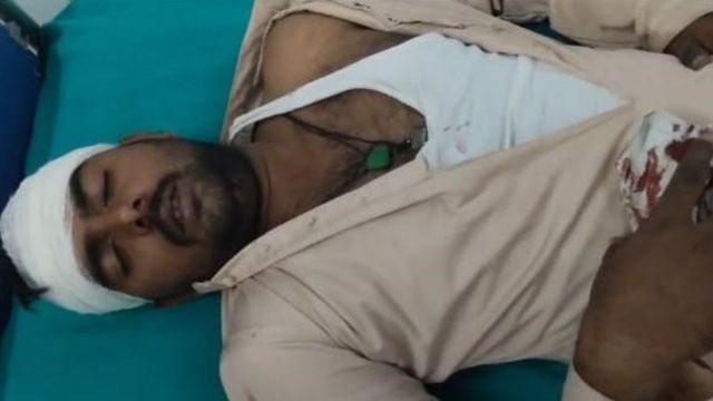 धनबाद में कीचड़ के छींटे पर भड़की पुरानी दुश्मनी: थाने में भिड़े दोनों गुट, जमकर चले लाठी-डंडे; 2 लोग घायल
