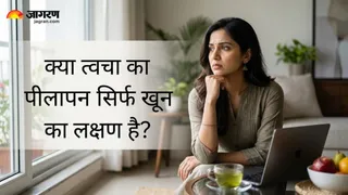 खून की कमी या कुछ और... आखिर क्यों फीका पड़ने लगता है त्वचा का रंग? जानिए कब डॉक्टर से मिलना है जरूरी (Image Source: AI-Generated)