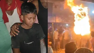 मुहर्रम के जुलूस में आग के खेल से घायल विराट। (फोटो जागरण)