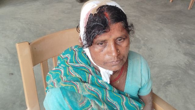 लखीसराय: बेटे ने लोहे की खंती से मां पर किया जानलेवा हमला, बचाने पहुंची भाभी का हाथ टूटा
