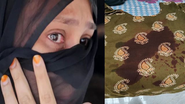 डाॅक्टर समेत दो महिलाओं के ऊपर बाइक सवार ने फेंकी स्याही, CCTV से पहचाना गया मनचला 
