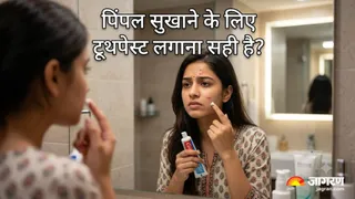 पिंपल सुखाने के चक्कर में खराब न करें चेहरा (Image Source: AI-Generated)