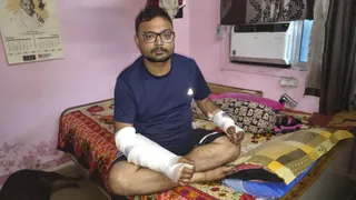 दोनों हाथ जख्मी कर पर्स लूटा