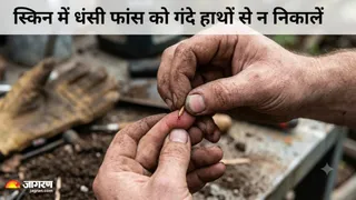 त्वचा से फांस निकालने के सही तरीके और सावधानियां (Picture Credit- AI Generated)