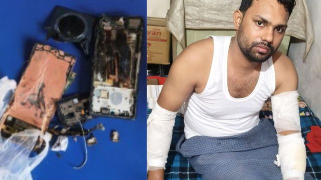 बाराबंकी में आवारा पशु से टकराकर गिरी बाइक, सड़क पर घिसटने से युवक की जेब में रखे मोबाइल में लगी आग
