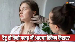 स्किन कैंसर का पता लगाने के लिए बनाया गया स्मार्ट टैटू (Picture Courtesy: Freepik)