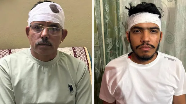 Pitbull Owner Attacks Police Sub Inspector And His Son :- कुत्तों की लड़ाई ने लिया हिंसक रूप, दारोगा और बेटे पर धारदार हथियार से हमला !
