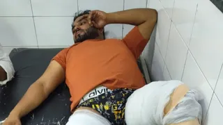 दिल्ली पुलिस के साथ मुठभेड़ में आरोपित के दोनों पैरों पर लगी गोली।
