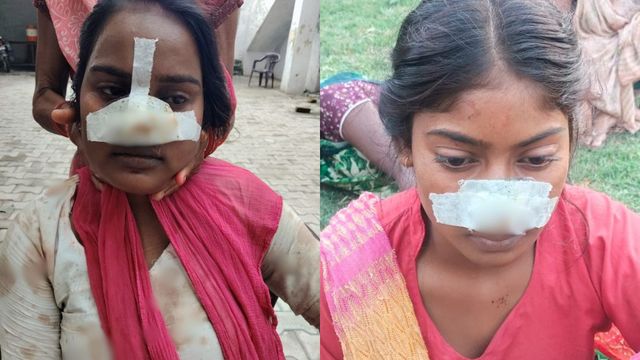 पति ने पत्नी तो सास ने दामाद की बहन की काटी नाक, लखीमपुर में मायके जाने की जिद पर हुआ हिंसक विवाद
