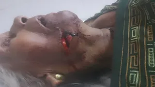मऊआइमा थाना क्षेत्र के मांदीपुर गांव में घायल सुखिया देवी। जागरण