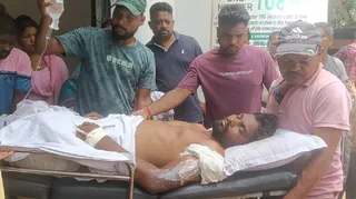 सेल की बोलानी लौह अयस्क खदान में शनिवार को करंट की चपेट में आने के बाद अस्पताल में इलाजरत घायल कर्मचारी।