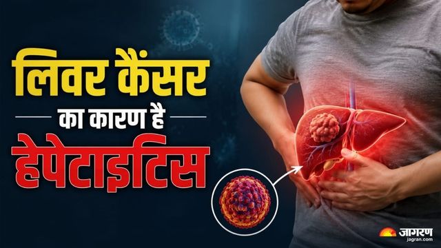 कमजोरी, पेट दर्द और भूख न लगना है हेपेटाइटिस का संकेत; इलाज न होने पर हो सकता है लिवर कैंसर