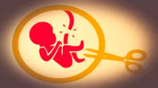 प्रयागराज के डफरिन अस्पताल में गर्भपात की संस्तुति को मेडिकल बोर्ड बनाया गया है।