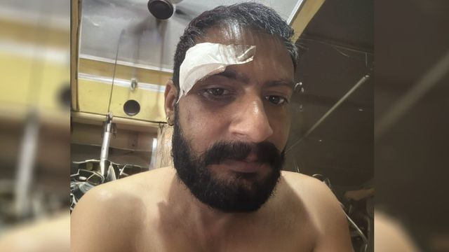 यमुनानगर में विशु हत्याकांड के आरोपी पर जानलेवा हमला, ममेरे भाई ने घेरकर डंडों-रॉड से पीटा; टांग टूटी
