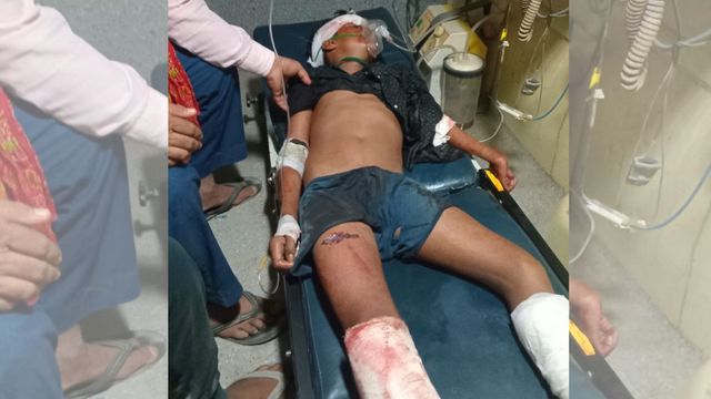 बगहा में तेज रफ्तार वाहन की टक्कर से 14 वर्षीय किशोर की मौत, फुटेज खंगाल रही पुलिस