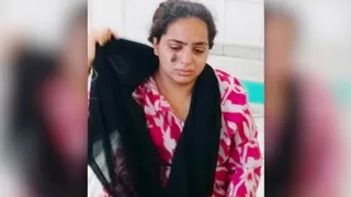 एसएसपी कार्यालय के बाहर पेट्रोल छिड़ककर आत्मदाह करने वाली सानिया को उपचार के लिए अस्पताल में भर्ती कराया गया जागरण