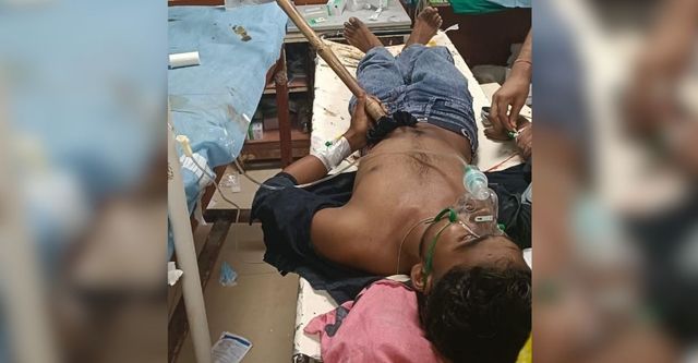 हमीरपुर में खेलते समय हादसा; भैंस पर बैठे किशोर ने गिल्ली कैच करने को लगाई छलांग, पेट में घुस गई छह इंच तक लाठी
