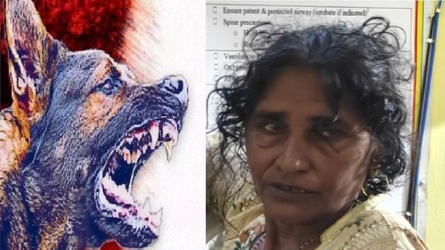 लापरवाही ने ली महिला की जान, कुत्ता काटने पर नहीं लगवाई वैक्सीन; दाे साल बाद रेबीज के लक्षण उभरने के अगले दिन मौत 
