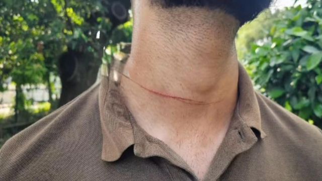 सावधान! जम्मू की सड़कों पर 'मौत का मांजा', बाल-बाल बची युवक की जान, कांपते हुए सुनाया खौफनाक मंजर
