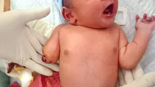 आजमगढ़ में नवजात का हाथ कटने पर एसआइटी गठित, दो क्लीनिक सील।