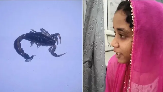 बच्ची के कान में से निकला बिच्छू।