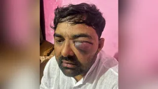 भारतीय किसान यूनियन बीआर आंबेडकर के अध्यक्ष दिग्विजय भाटी