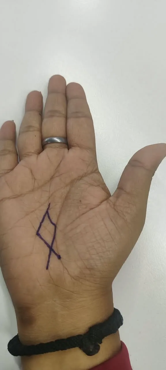 fish sign on palm brings immense wealth as per palmistry