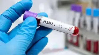 एच1एन1 मामलों में वृद्धि मौसमी इन्फ्लुएंजा का सामान्य हिस्सा